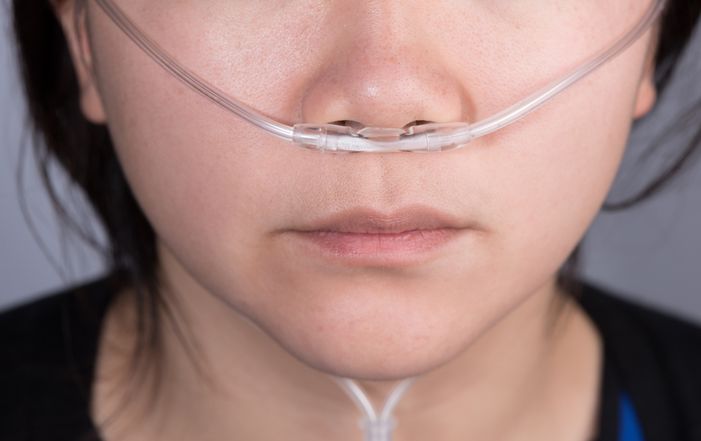 Nasal Cannula